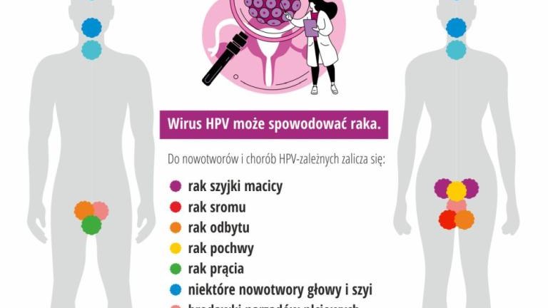 Szczepienia przeciw HPV_infograph_2.jpg